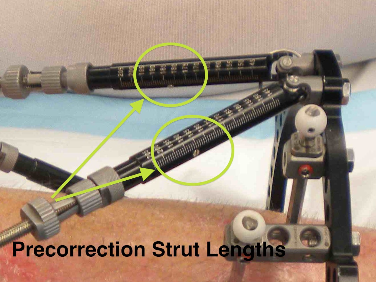 TSR Strut Measurements Pre Correction